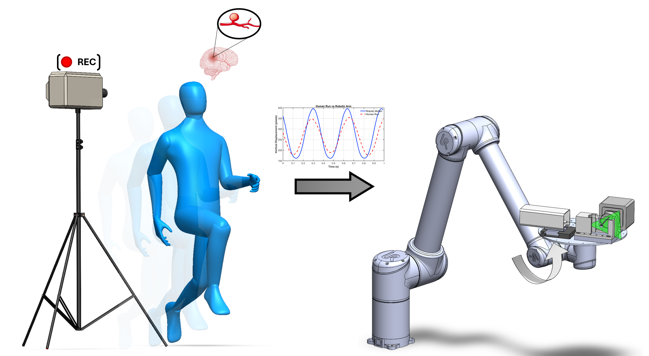 Cover image for Hemodynamic study in Patient-Specific Cerebral Aneurysms