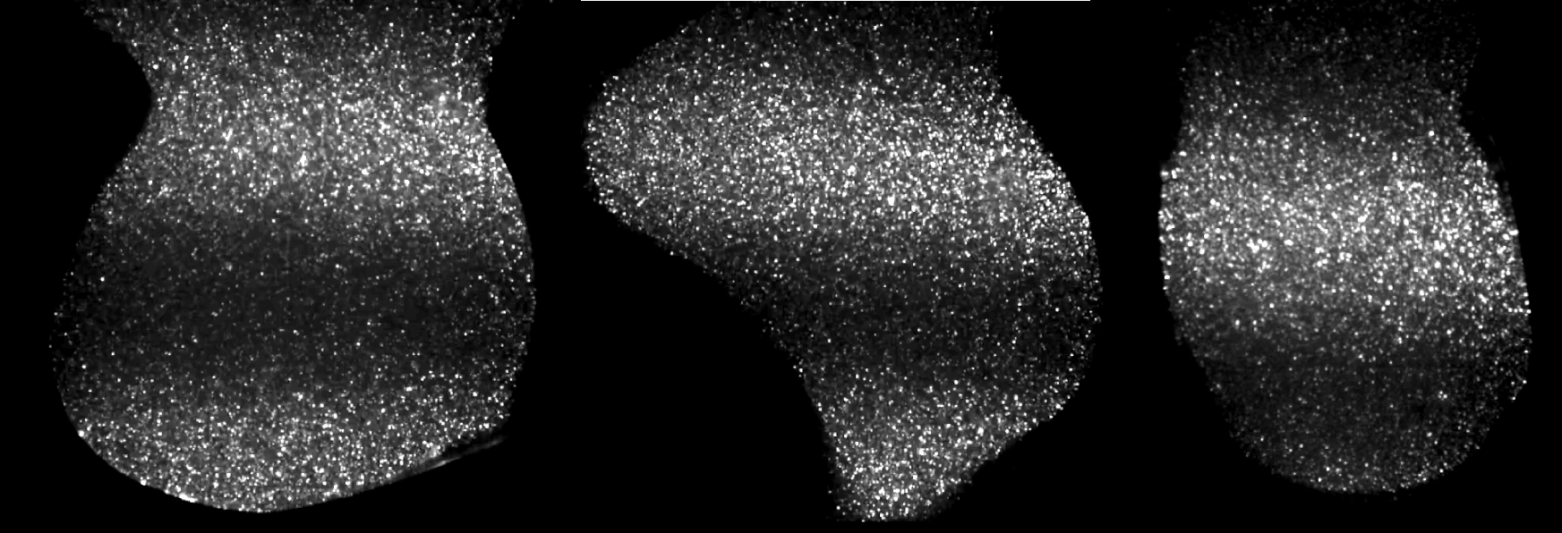 Cover image for Modeling Patient-Specific Aneurysms
