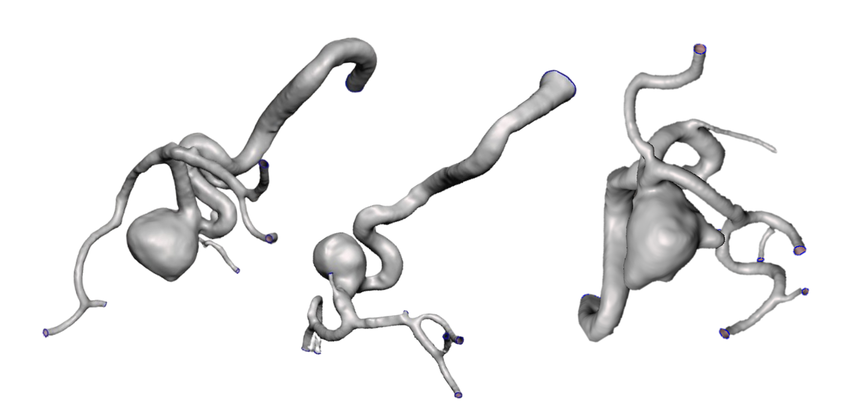 Cover image for Aneurysm-Phantom-Fabrication